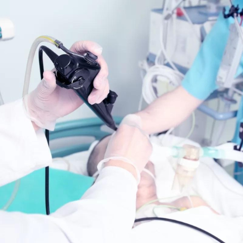 Detalii articol - Cum mă pregătesc pentru efectuarea Gastroscopiei?