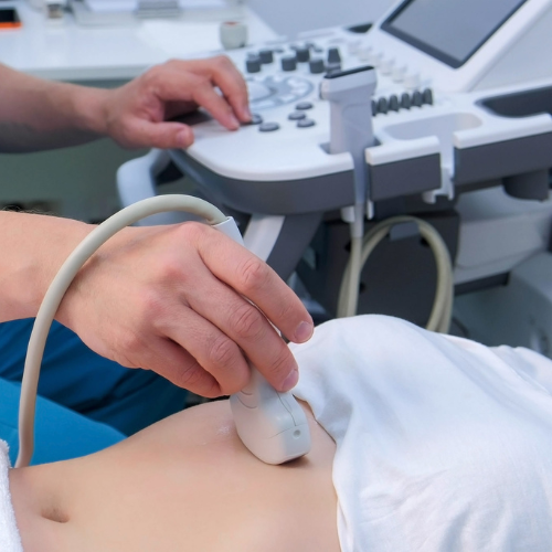 Detalii articol - Cum ne pregătim pentru efectuarea unei ecografii abdominale?