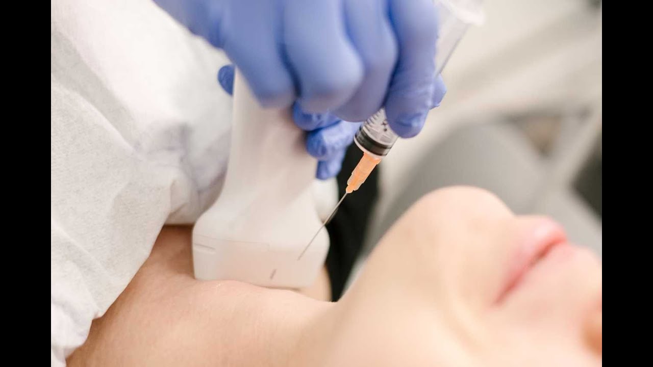 Detalii articol - Puncție – biopsie tiroidiană cu ac fin