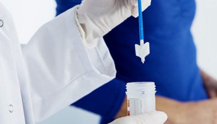 Detalii articol - Test Babeș Papanicolau/HPV